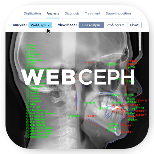 Webceph App Sovrapponi Teleradiografie e foto laterale | WEBCEPH